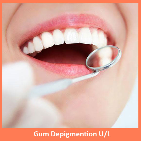 Gum Depigmention U/L